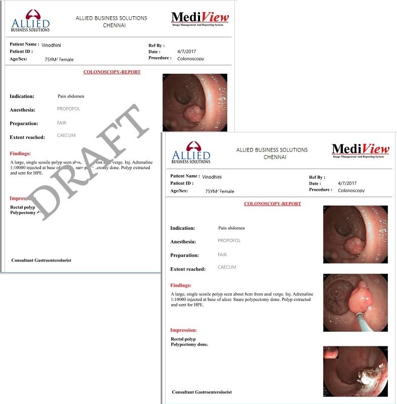 Sample Report generated from MediView software