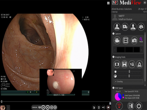 MediView Imaging Software depicting a endoscopic image